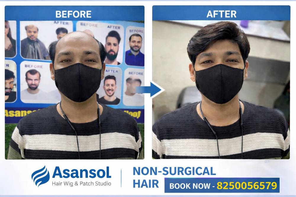 Hair Wig Before & After Result