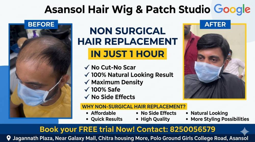 Hair Patch Before & After Result