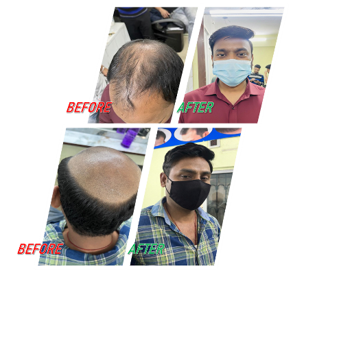 Before & After Comparison